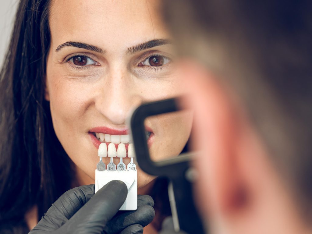 elegir el color del esmalte dental