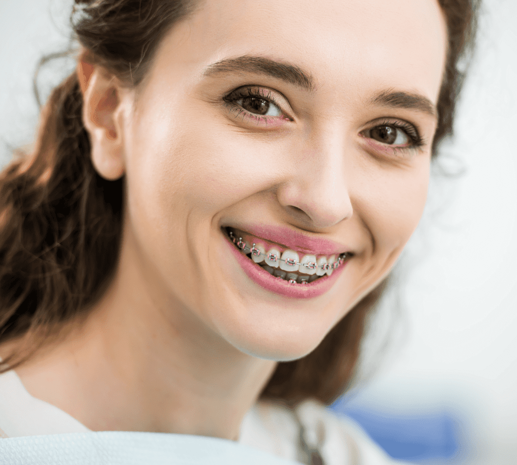 Paciente sonriendo con ortodoncia – BellaDent, clínica dental en Mislata